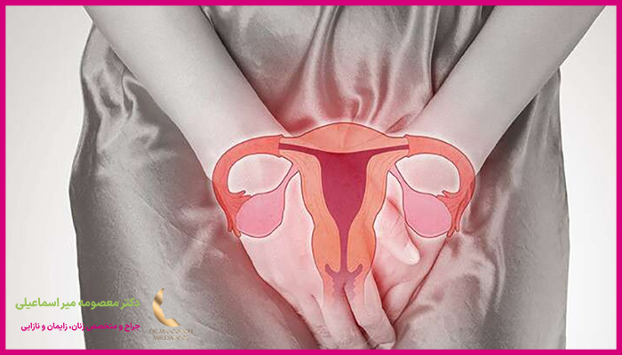 جراحی هودکتومی چه زمانی پیشنهاد می شود؟