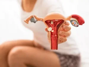 لاپاراسکوپی اندومتریوز روشی برای تشخیص و درمان