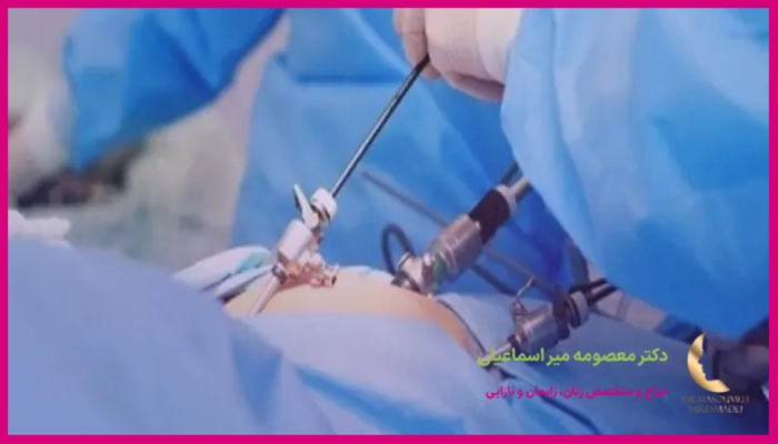 شانس بارداری بعد از لاپاراسکوپی چقدر است؟