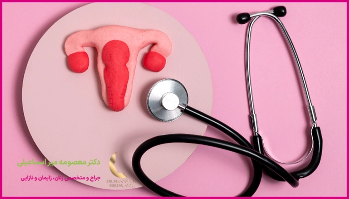 آیا پیشگیری از فیبروم رحم ممکن است؟
