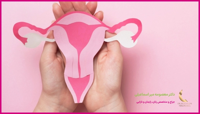 علت ایجاد تنبلی تخمدان